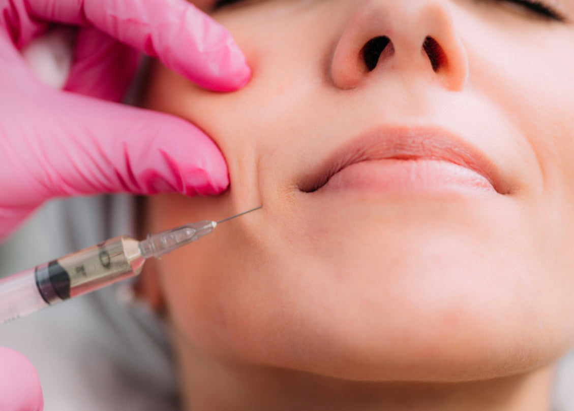 Nasolabial folds dermal filler training demonstration