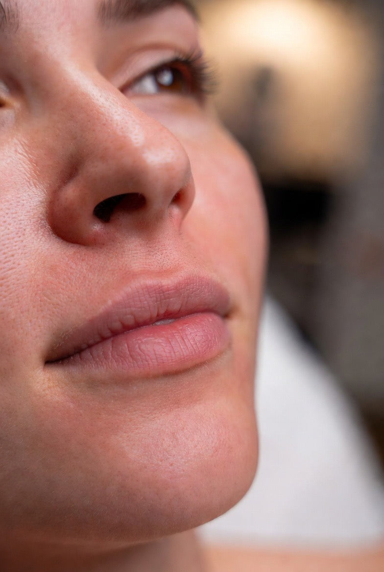 Online Botox training course for downturned mouth showing DAO injection techniques and results